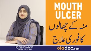 Munh Men Chale Kyun Hote Hain  Munh Mein Chhale Ka Ilaj  Mouth Ulcers Causes & Treatment In Urdu