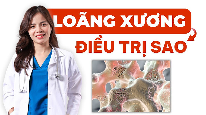 Chỉ số sos m s trong loãng xương là gì năm 2024