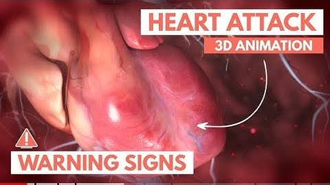 Recognizing a heart attack | 3D Animation #heart #heartbreak #cardio #cardiology #heartattack#reels