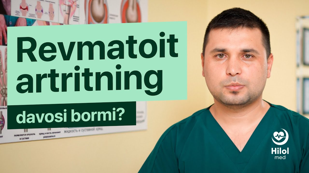 Revmatoit artrit kasalligini davosi bormi?