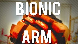 Celebrity Building My New Bionic Arm Net Worth