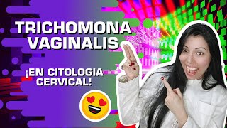 Trichomonas vaginalis🤕 in gynecological cytology.