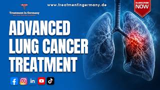 Advanced Lung Cancer Treatment in Germany: Innovative Treatment Options