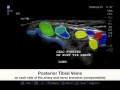 How To: Ankle - Tarsal Tunnel Case Study Video