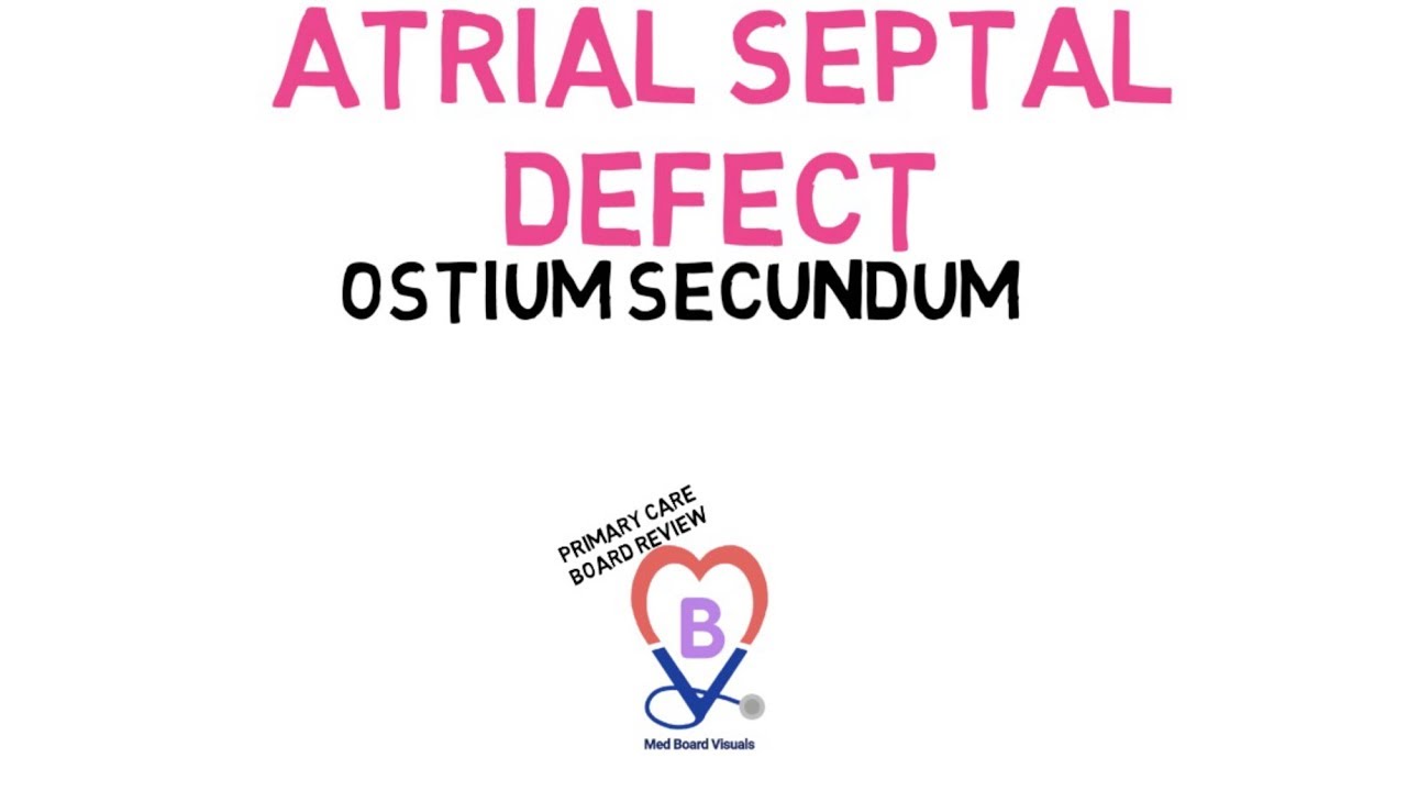 Atrial Septal Defect (Ostium Secundum)
