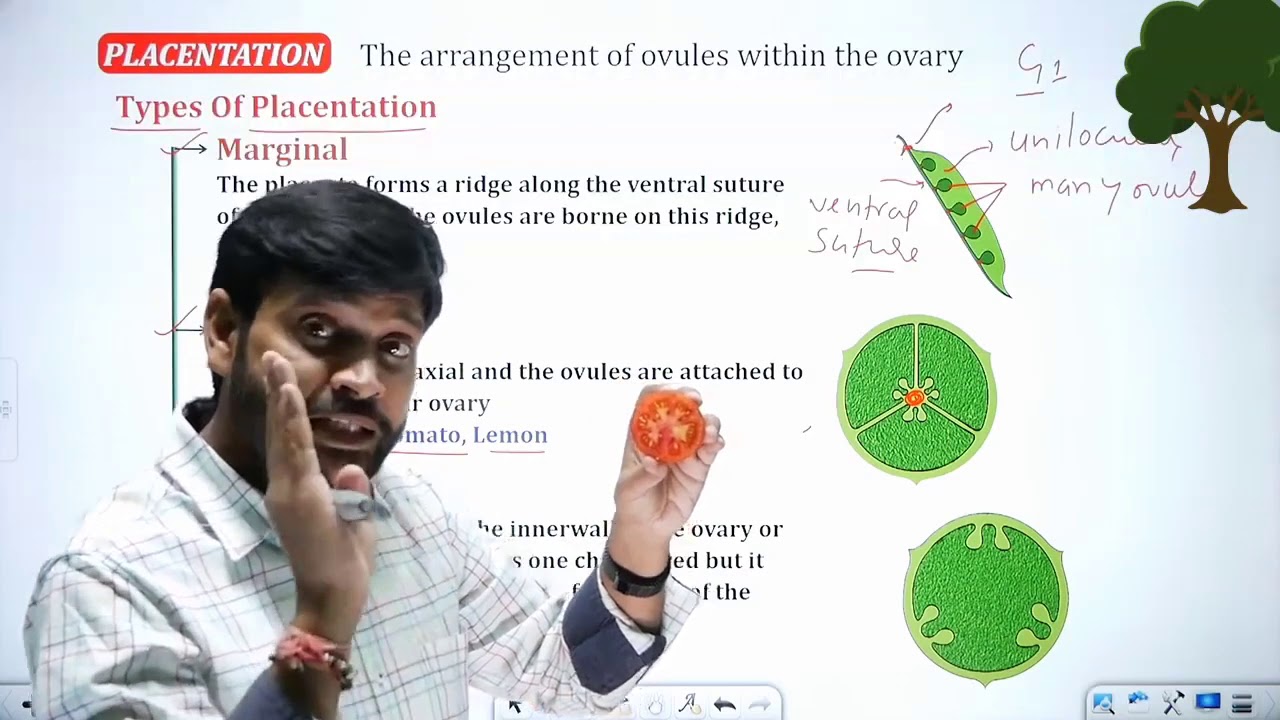Types of Placentation