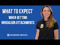 What to Expect When Getting Invisalign Attachments