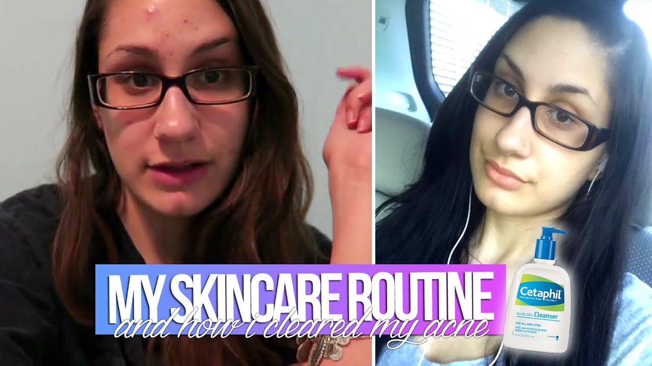 My Skincare Routine + How I Cleared My Acne! - YouTube