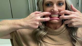 DIY Intraoral Photos: Virtual Appointments screenshot 5