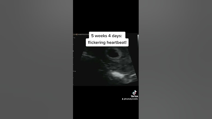 5 weeks 4 days pregnant- look at how tiny the baby is!