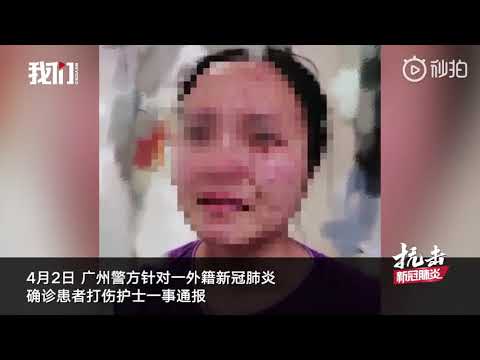 【#外籍新冠肺炎确诊患者殴打护士咬伤其脸部# 广州警方立刑事案调查】