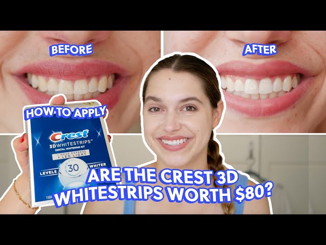 Crest 3DWhitestrips Professional White with LED Accelerator Light