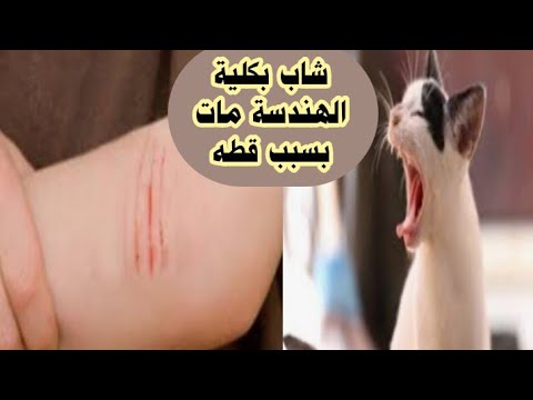شاب بكلية الهندسة ما ت بسبب خربشة قطه