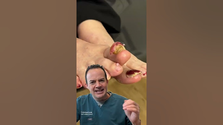 DOCTOR REACTS: WHEN YOU DON’T CUT YOUR TOENAILS! 😱 #Shorts