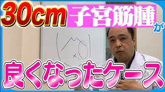 子宮筋腫 Youtube 子宮筋腫 Youtube
