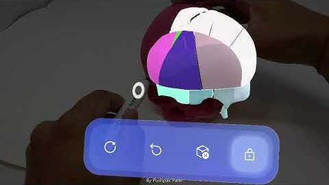 VSP Planning via HoloLens 2 on a  3D model.