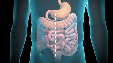 Colon Resection