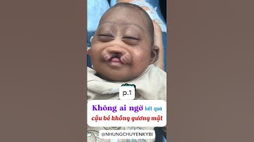 [P.1] Không ai ngờ cái kết cậu bé không khuôn mặt #shorts