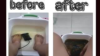 I tried this and here's the results  Could Detox Foot Baths Actually Remove Toxins From Your Body ? by marzkhia 65 views 1 year ago 1 minute, 5 seconds