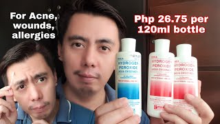 HOW TO TREAT PIMPLES/ ACNE USING RHEA HYDROGEN PEROXIDE (AGUA OXYGENADA) | REAL TALK DEMO & REVIEW