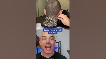 Thumbnail of Crazy tick removal? Or fake?