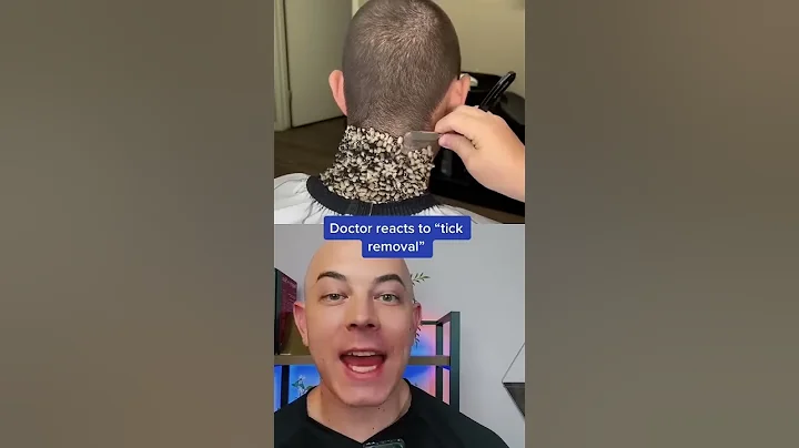 Crazy tick removal? Or fake? - DayDayNews