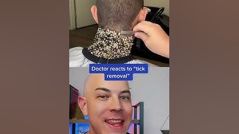 Crazy tick removal? Or fake?