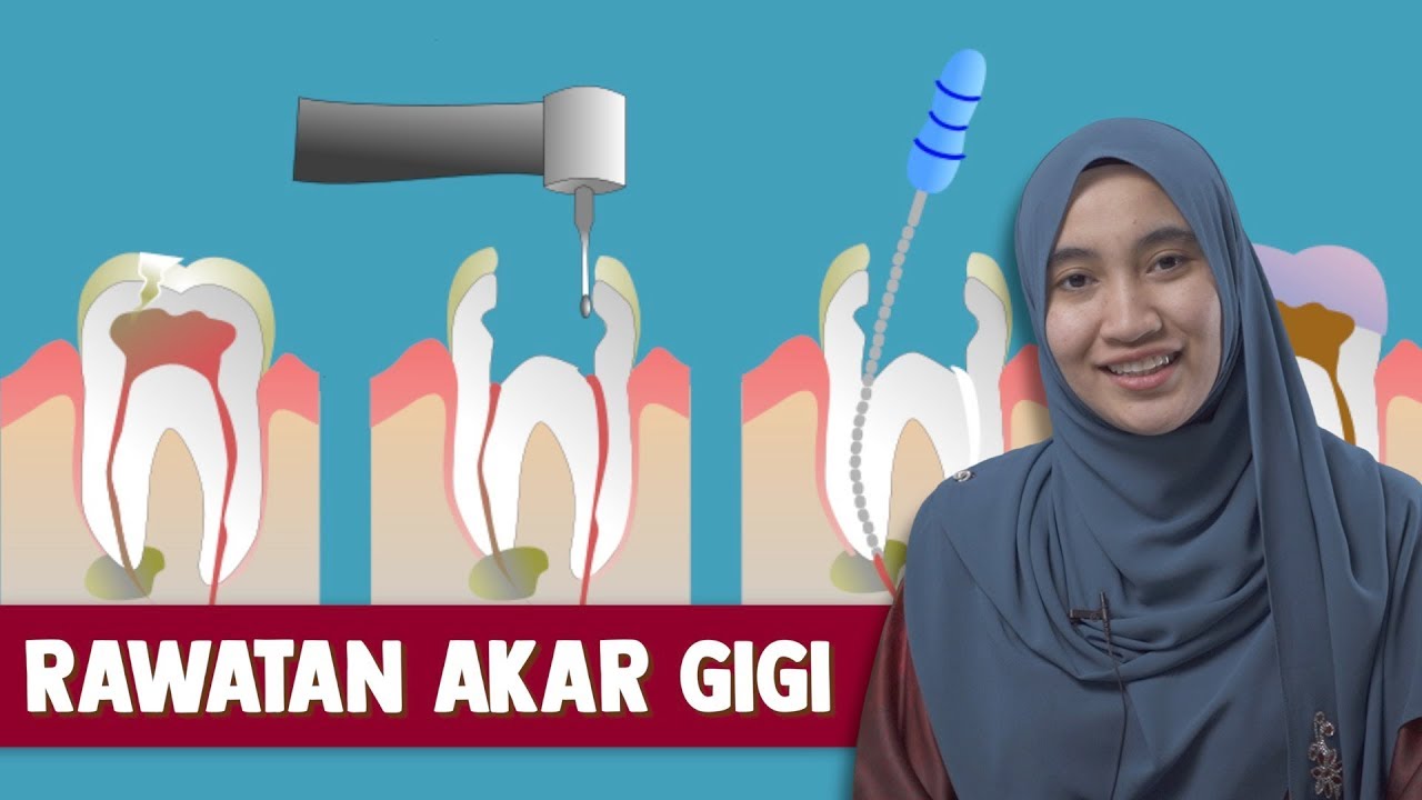 Klinik Gigi Terbaik di Jogja