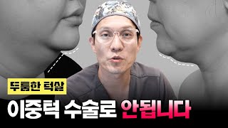 ​이중턱 수술 턱살이 있다고 무조건 필요한게 아니에요! 이중턱 유형별 수술 찾기🔍｜턱선 리프팅｜미니목거상｜마인성형외과｜マイン美容外科