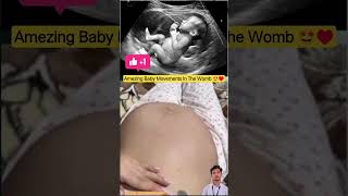 Amezing Baby Movements In The Womb🤩😍 | Nursing Educational video #babycare #pregnancy #shortsfeed