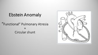 Ebstein anomaly: "functional" pulmonary atresia and "circular" shunt
