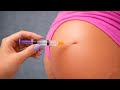 Simple Step-by-Step Guide | How to Give a Safe & Painless Injection