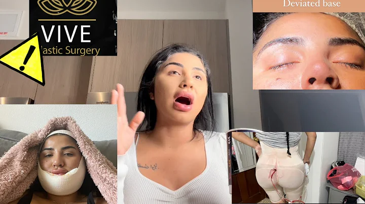 RATING MY ALL OF MY SURGEONS  | TRUTH ABOUT VIVE