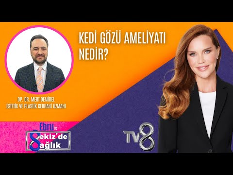 KEDİ GÖZÜ AMELİYATI NEDİR?| OP. DR. MERT DEMİREL | 8'de Sağlık