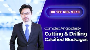 Complex Angioplasty - Cutting & Drilling Calcified Blockages