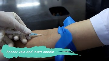 PHLEBOTOMY VENIPUNCTURE (SYRINGE METHOD)