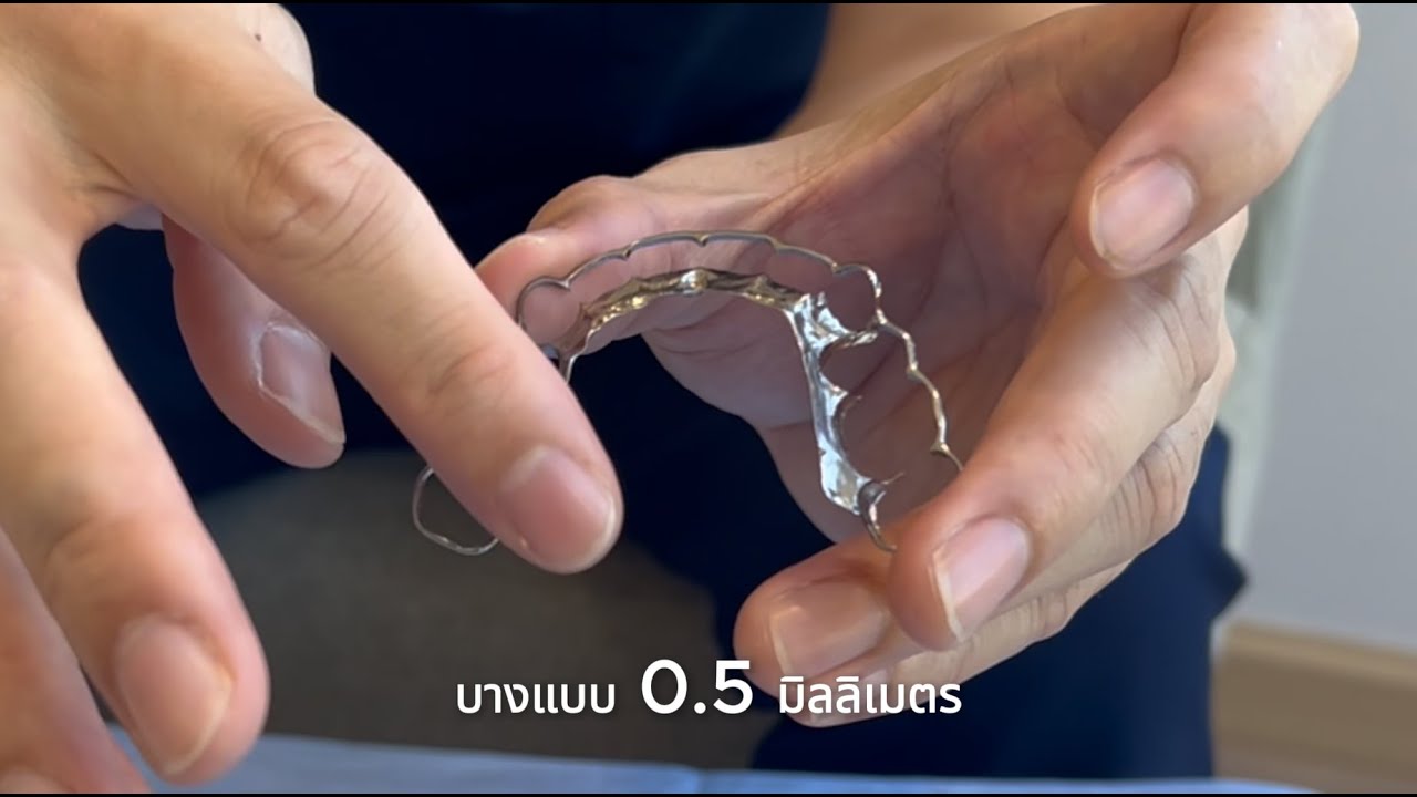 Taitanium Retainer รีเทนเนอร์ที่หมอเลือก!