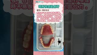 吸附性義齒 | 活動假牙 | 優勢全解 | 全口缺牙怎麼辦 | 深圳活動假牙診所推薦 | 深圳牙科 | 護芽口腔