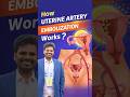 No Big Surgery! How UAE Treats Fibroids | Dr Arjunlokesh