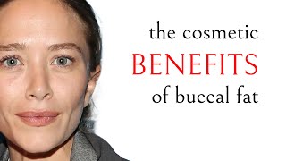 Cosmetic benefits of keeping buccal fat | Perioral Mounds + Jowls | Facial Sculpting with Dr. Zelken