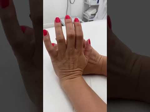 Video: 3 moduri de a strânge pielea feței