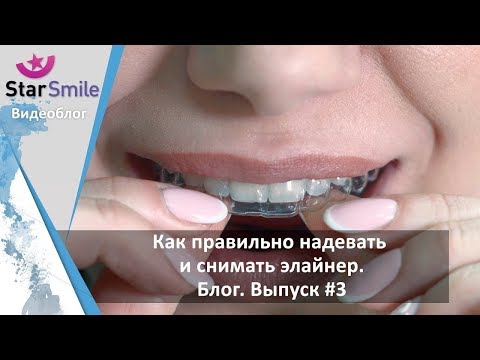 Как правильно надевать и снимать элайнер. Блог. Выпуск #3