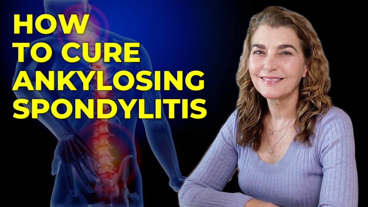 How To Cure Ankylosing Spondylitis – Back Pain — Transcript