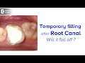 How long can you keep a temporary filling after root canal? - Dr. Chandan Mahesh