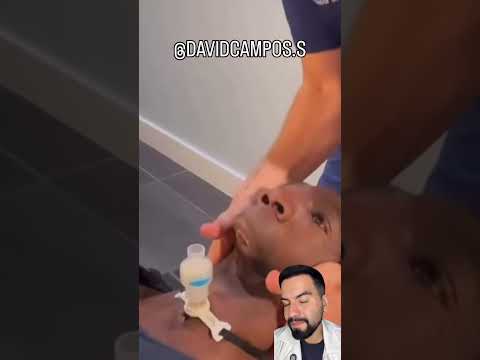 NACIÓ SIN MANDÍBULA