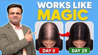 Finding More Hair in The Shower? Do This Now (Doctor's Protocol)