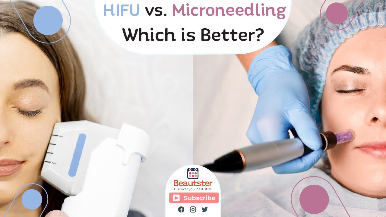 Microneedling vs HIFU, which one is better for you? YouTube