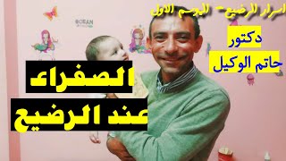 الصفراء / اليرقان عند الرضيع - دكتور حاتم الوكيل - ساعدنى يا دكتور