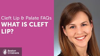 What Is A Cleft Lip? | Boston Children’s Hospital