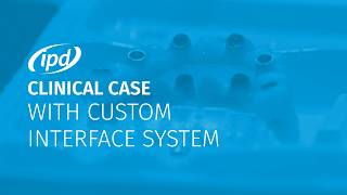 Clinical case with Custom Interface System